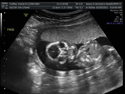 Baby's face