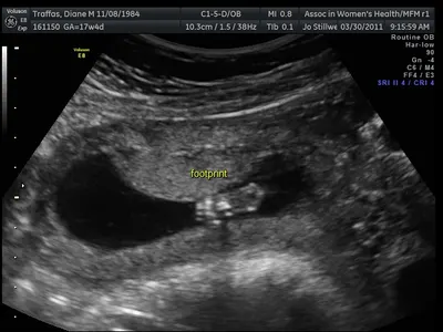 Baby Traffas's Footprint